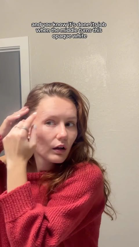 Instagram post by @theblemishqueen for Dots for Spots. Caption reads: THE HOTTEST STOCKER STUFFERS‼️‼️‼️
@dotsforspots....