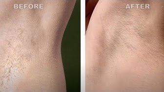 YouTube post by @shoppingwithamy for Ulike. Caption reads: I Found 2025's Best At-Home Hair Removal? |....