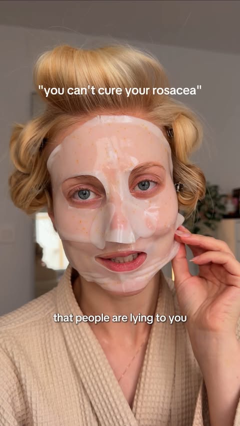 Instagram post by @billieblonde_ for Mamonde. Caption reads: [...] Rosacea girls! You need to know this…😅....