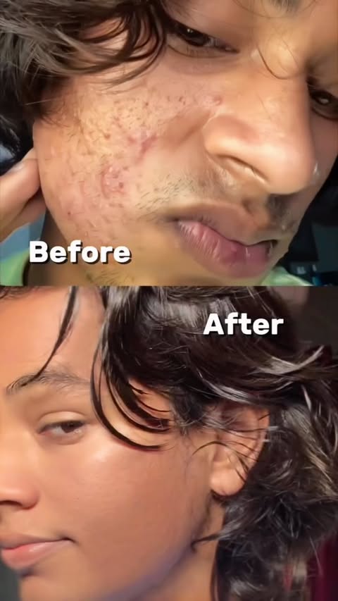 Instagram post by @medicalworld_offical for Chemist at Play. Caption reads: [...] Best face wash for sensitive skin,chemist at....