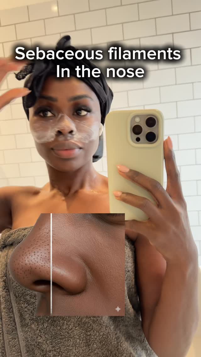 Instagram post by @thisisemilyb for Kate Somerville. Caption reads: Those tiny dots on your nose?
They’re not....