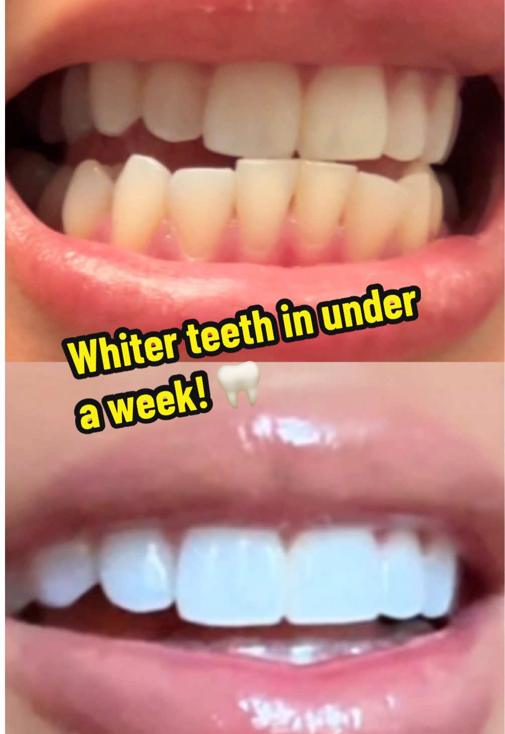 TikTok post by @jennybabascomedy for PurelyWHITE Deluxe. Caption reads: [...] 🙌🏼 #teethwhitening #purelywhite....