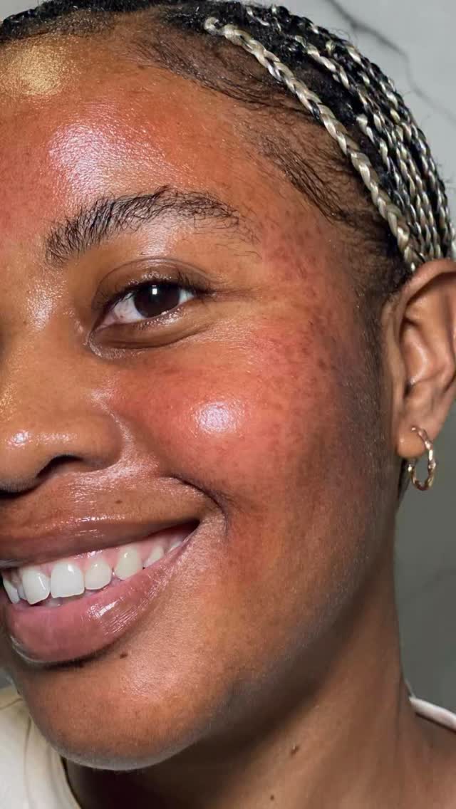 Instagram post by @simphiwee_mb for Banish. Caption reads: [...] all three microneedling heads on the Banish....