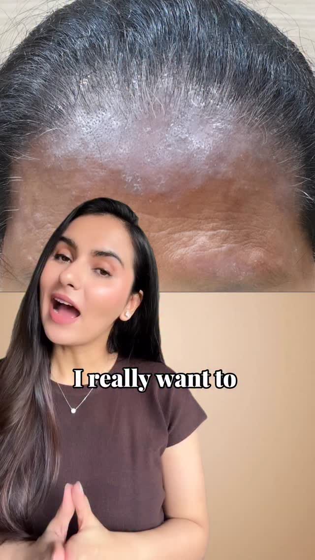 Instagram post by @skin_by_dr.shivangi for Indus Valley Organic Beauty. Caption reads: “✨This Festive, Say No To Quick Fix✨

❌ Because....