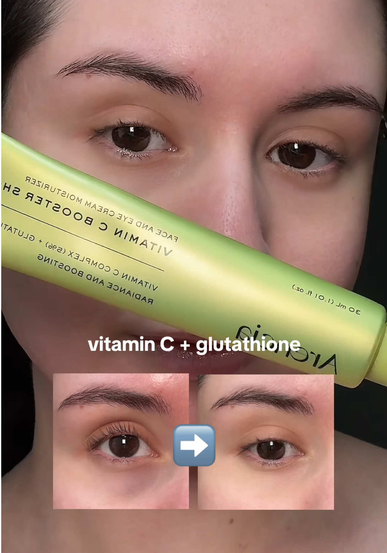 TikTok post by @iredefh for arencia. Caption reads: [...] acne scars and brightens dark spots.....