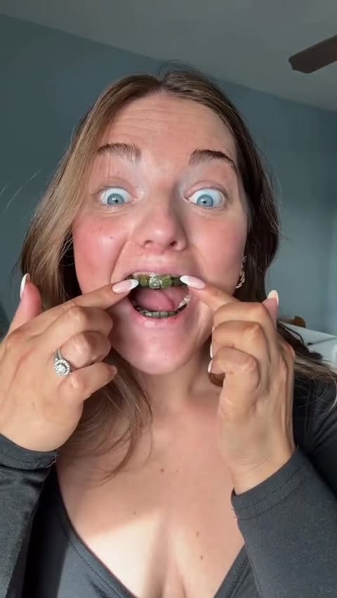 Instagram post by @kallibredsguard for Inopro. Caption reads: [...] put green strips on your teeth?👀 #fyp....