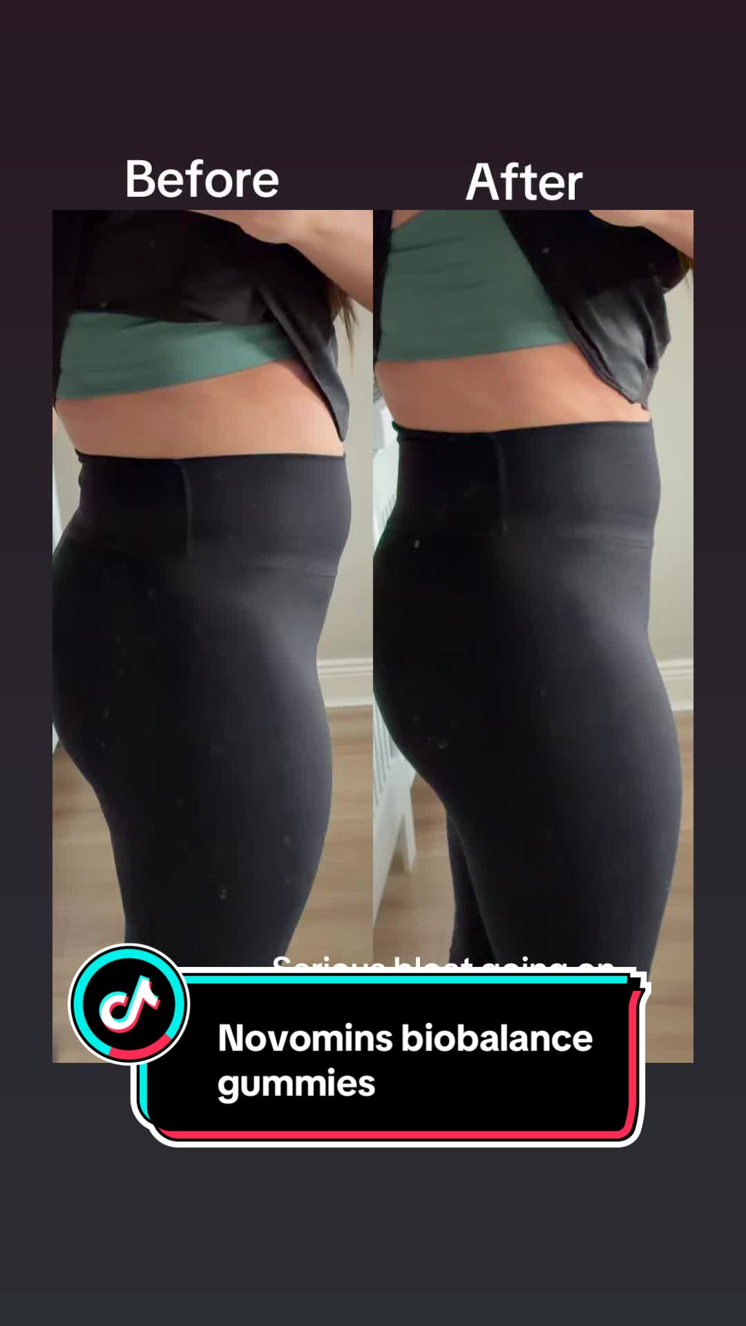 TikTok post by @amykelly2191 for Novomins. Caption reads: [...] #guthealth #digestion #bloat....