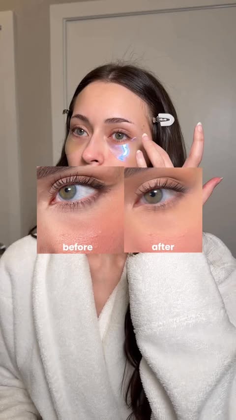 Instagram post by @kiediazz for I Dew Care. Caption reads: [...] under eyes in the world thank to @idewcare....