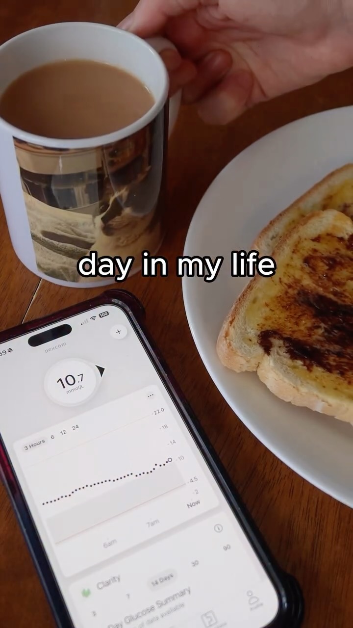 Instagram post by @aliciaadorna for Dexcom. Caption reads: ✨ Meet Dexcom G7 – the small, comfortable, and....