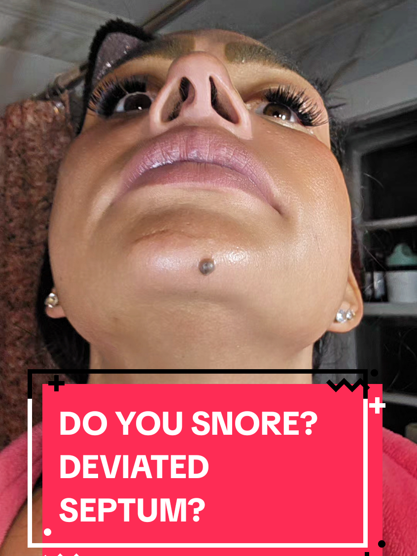 TikTok post by @kelzzzzzzzzzz33 for Intake Breathing. Caption reads: [...] is becoming a daily essential. @Intake....