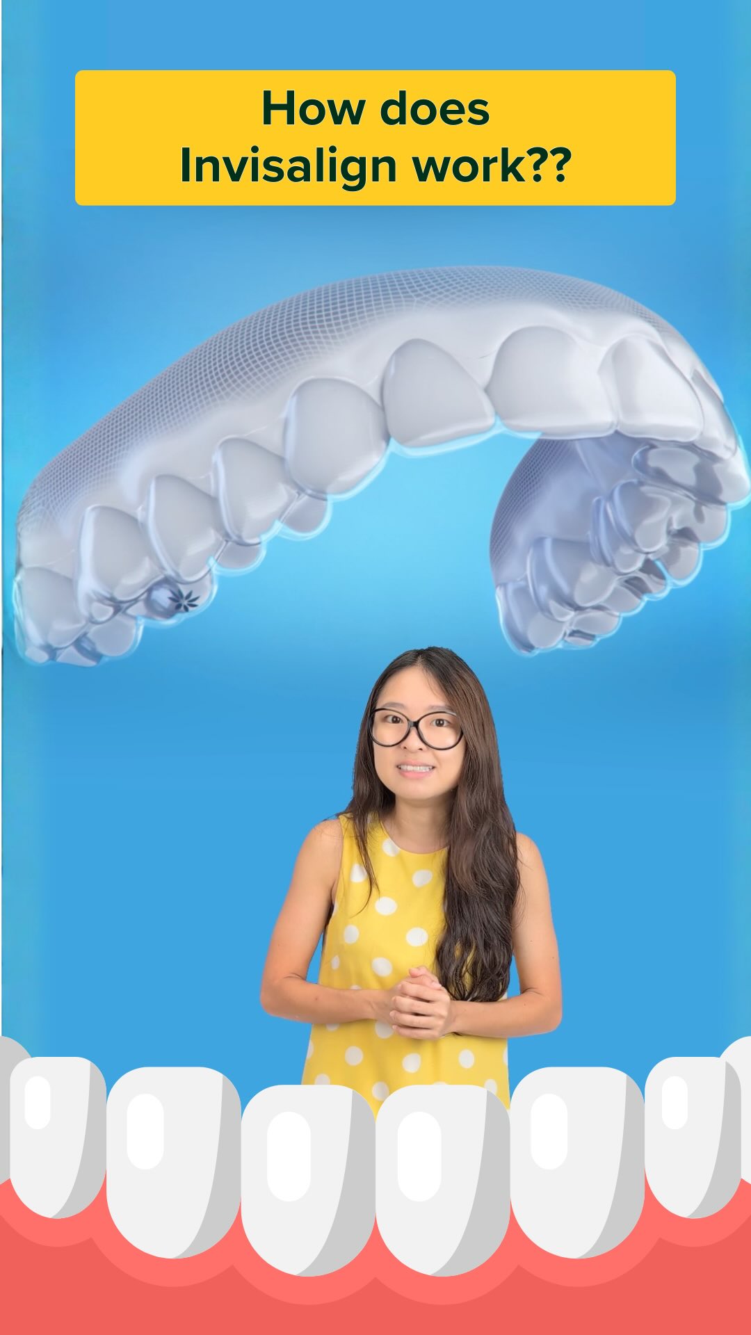 Instagram post by @justkeepthinkingsg for Invisalign. Caption reads: Curious about clear aligners? We got the chance to....