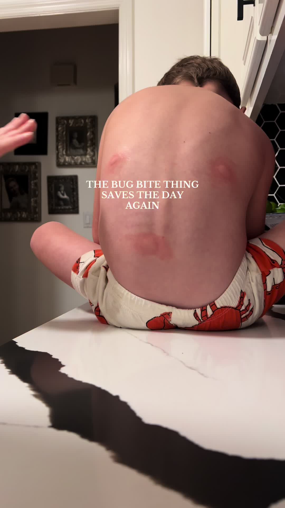 TikTok post by @thejessiesimpson for Bug Bite Thing. Caption reads: [...] means bug bites! Make sure you have @Bug....