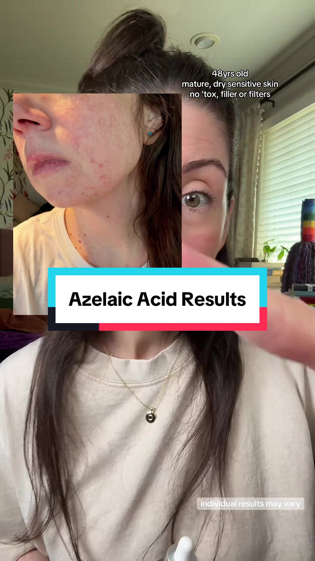 TikTok post by @christystitchespt2 for Anua Store US. Caption reads: [...] Individual results may vary. @Anua Store US....