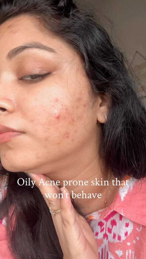 Instagram post by @yourskincareally for Foxtale. Caption reads: [...] acne solution, simple skincare #foxtale....