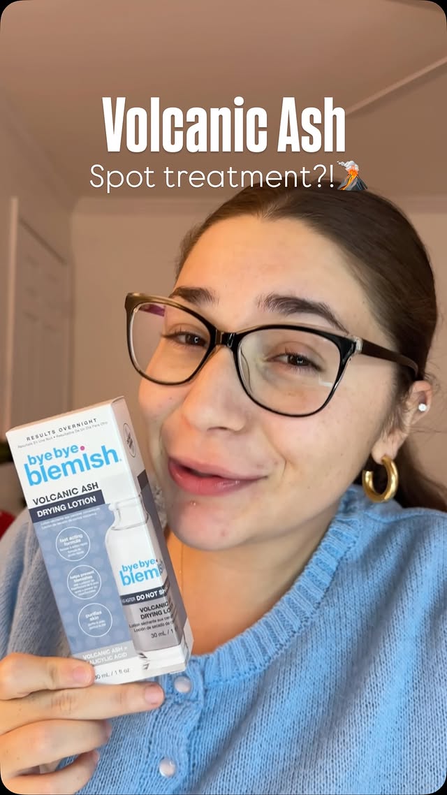 Instagram post by @adrianabernardii for Bye Bye Blemish. Caption reads: [...] thing I’ve put on my pimples yet 👀....