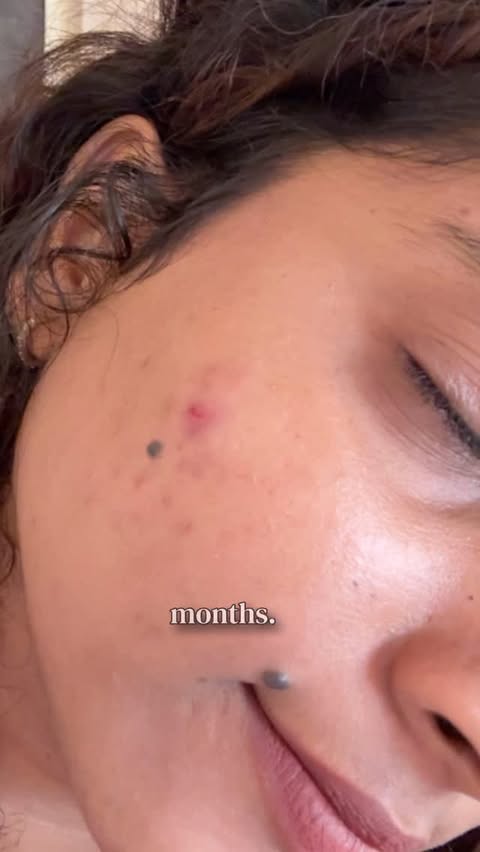 Instagram post by @insanenaari for OZiva. Caption reads: [...] not a covered-up one — so I started OZiva....