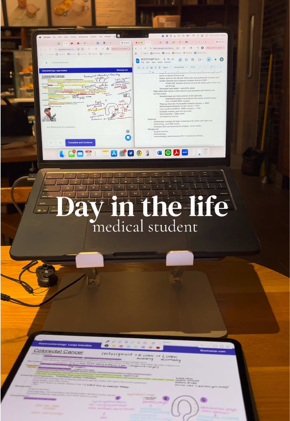 TikTok post by @brookeventer444 for Notion. Caption reads: Med school day in the lifeeeeeee<3333333....