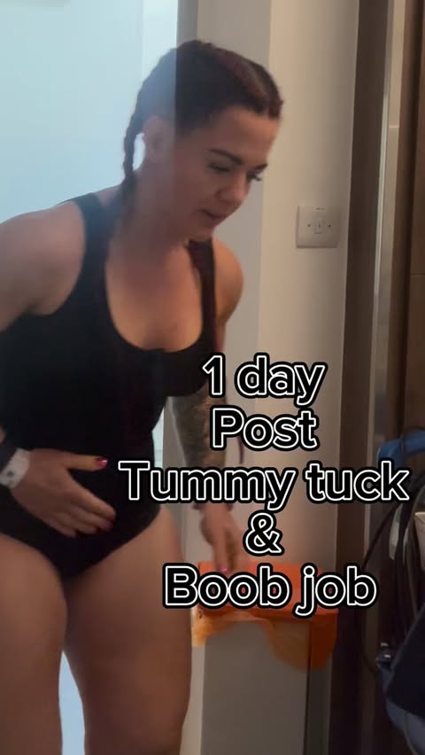 Instagram post by @iam_nbfitness for Esn. Caption reads: 1 day post op - tummy tuck and boob job 🫶🏼

Day....