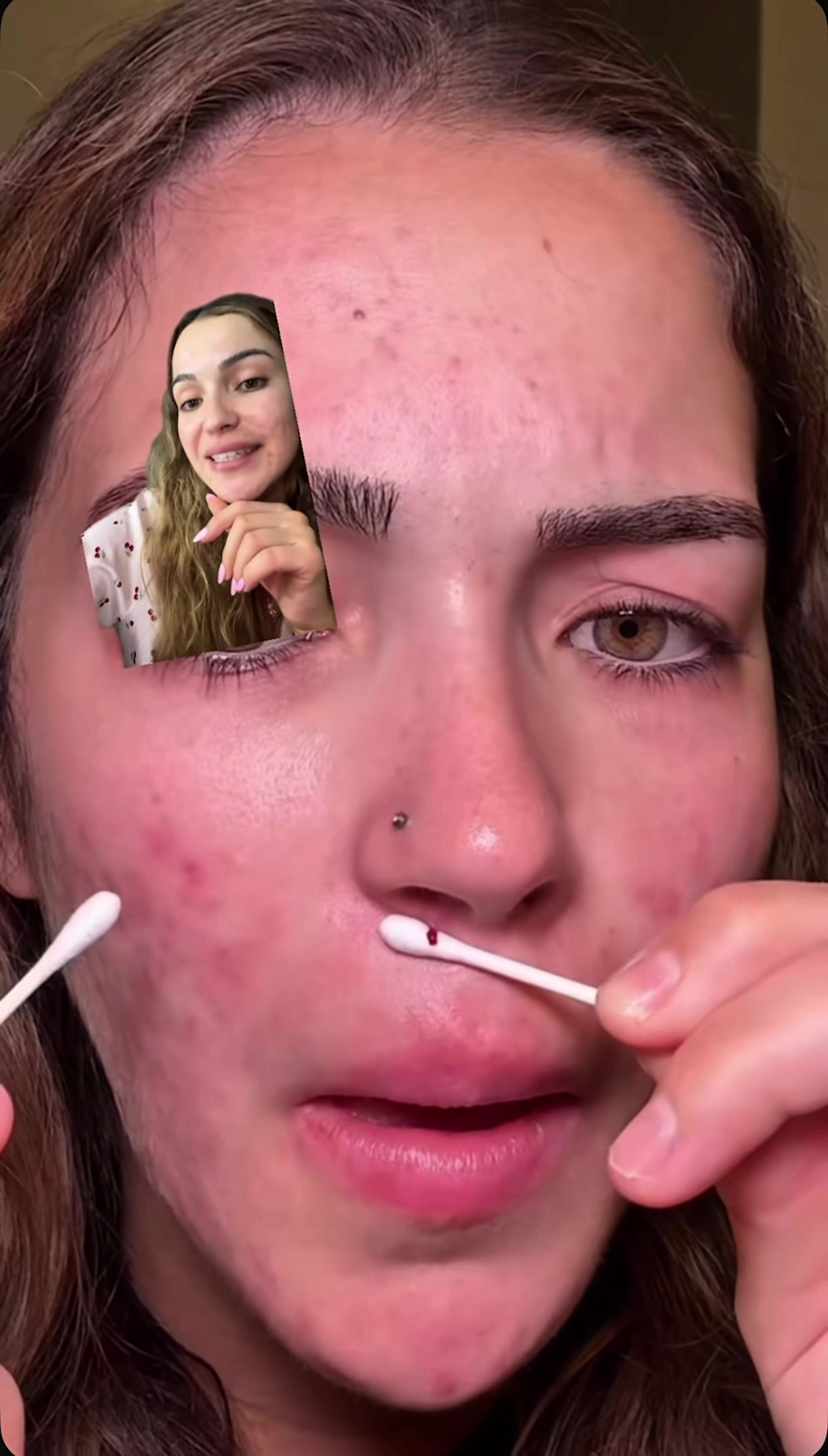 TikTok post by @jzozzy for Peace Out Skincare. Caption reads: Make sure these @PeaceOutSkincare Acne Dots are in....