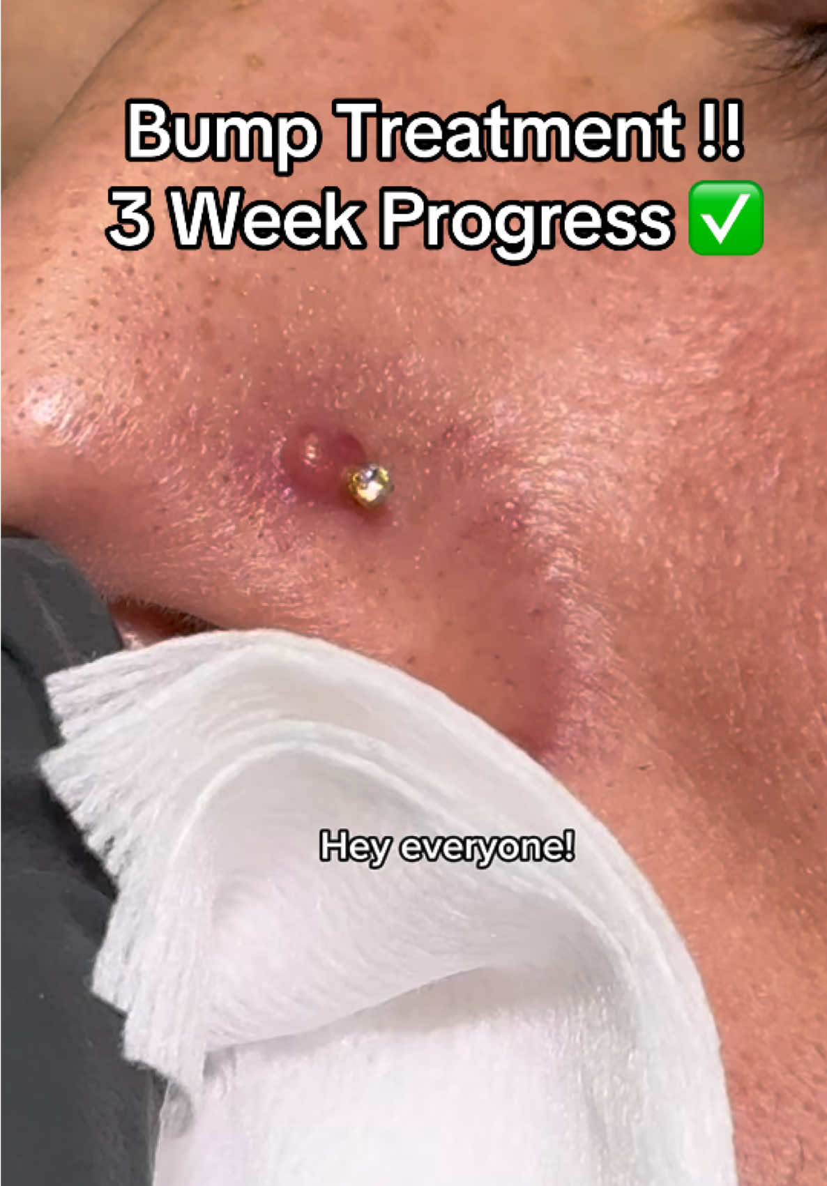 TikTok post by @anamarpiercings for Base Laboratories. Caption reads: I love a happy ending 😌 @Base Laboratories....