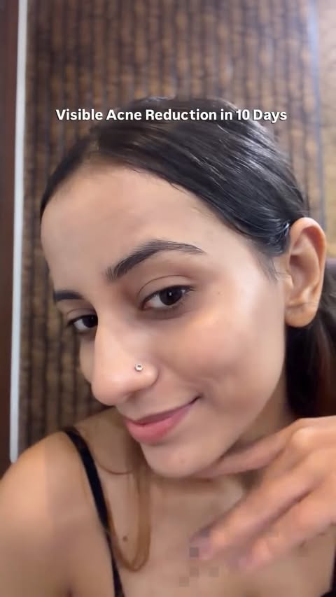 Instagram post by @dikshataneja__ for D'Acne by Glenmark. Caption reads: Tried everything, but your skin still isn’t happy?....