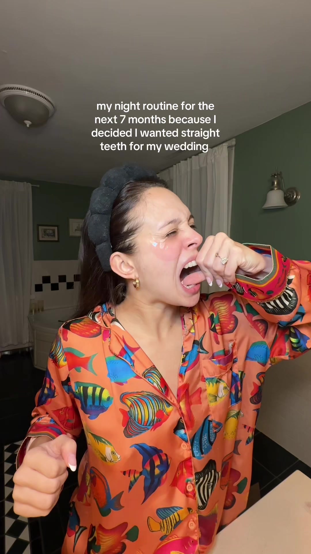 TikTok post by @ashleyccorbo for Invisalign. Caption reads: I probably shouldn’t have waited to get Invisalign....