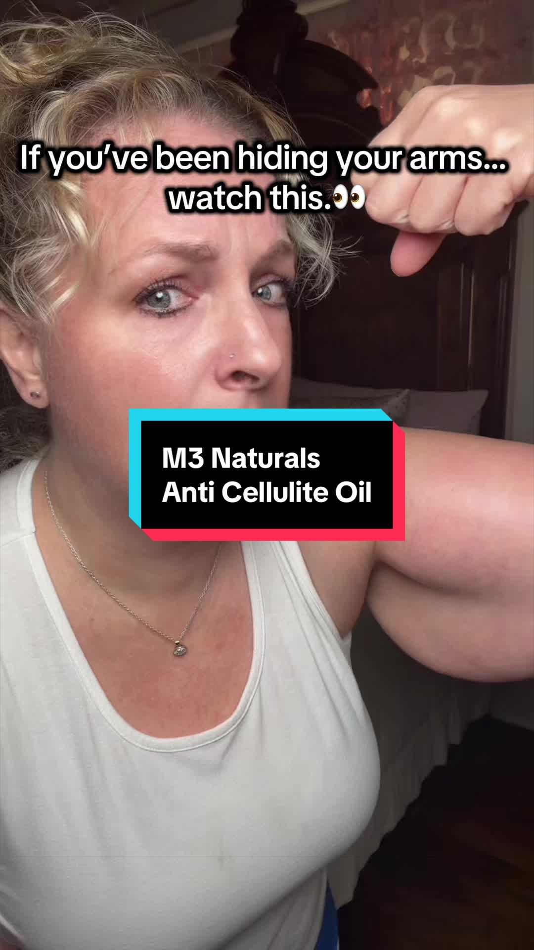 TikTok post by @firecracker816 for M3 Naturals. Caption reads: [...] showing my arms. Not medical advice.....