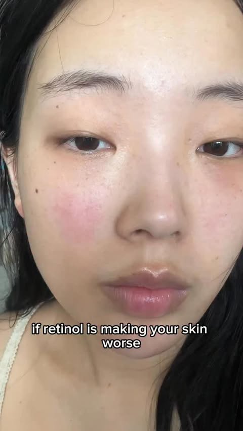 Instagram post by an influencer for Epii Global. Caption reads: How to use retinol CORRECTLY to avoid purging !!....