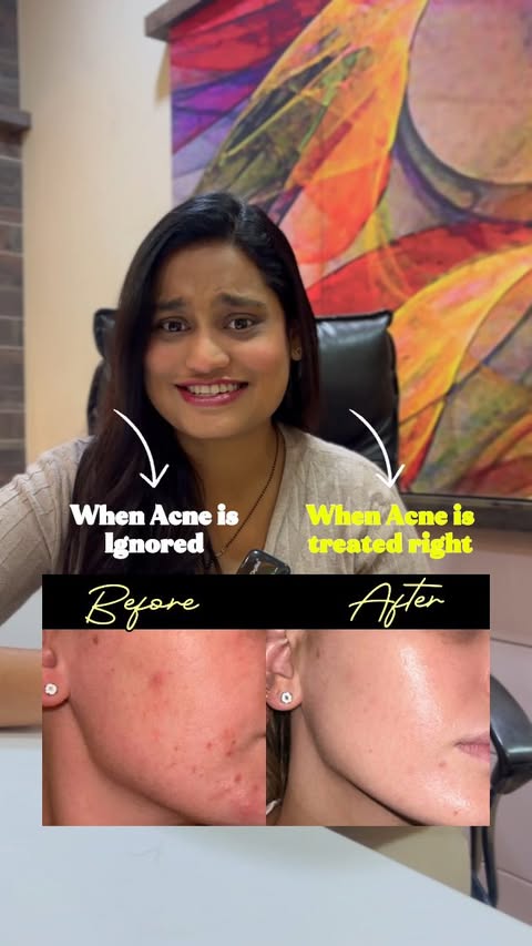 Instagram post by an influencer for The Derma Co. Caption reads: [...] DIY to real actives 🧪 the @thedermacoindia....