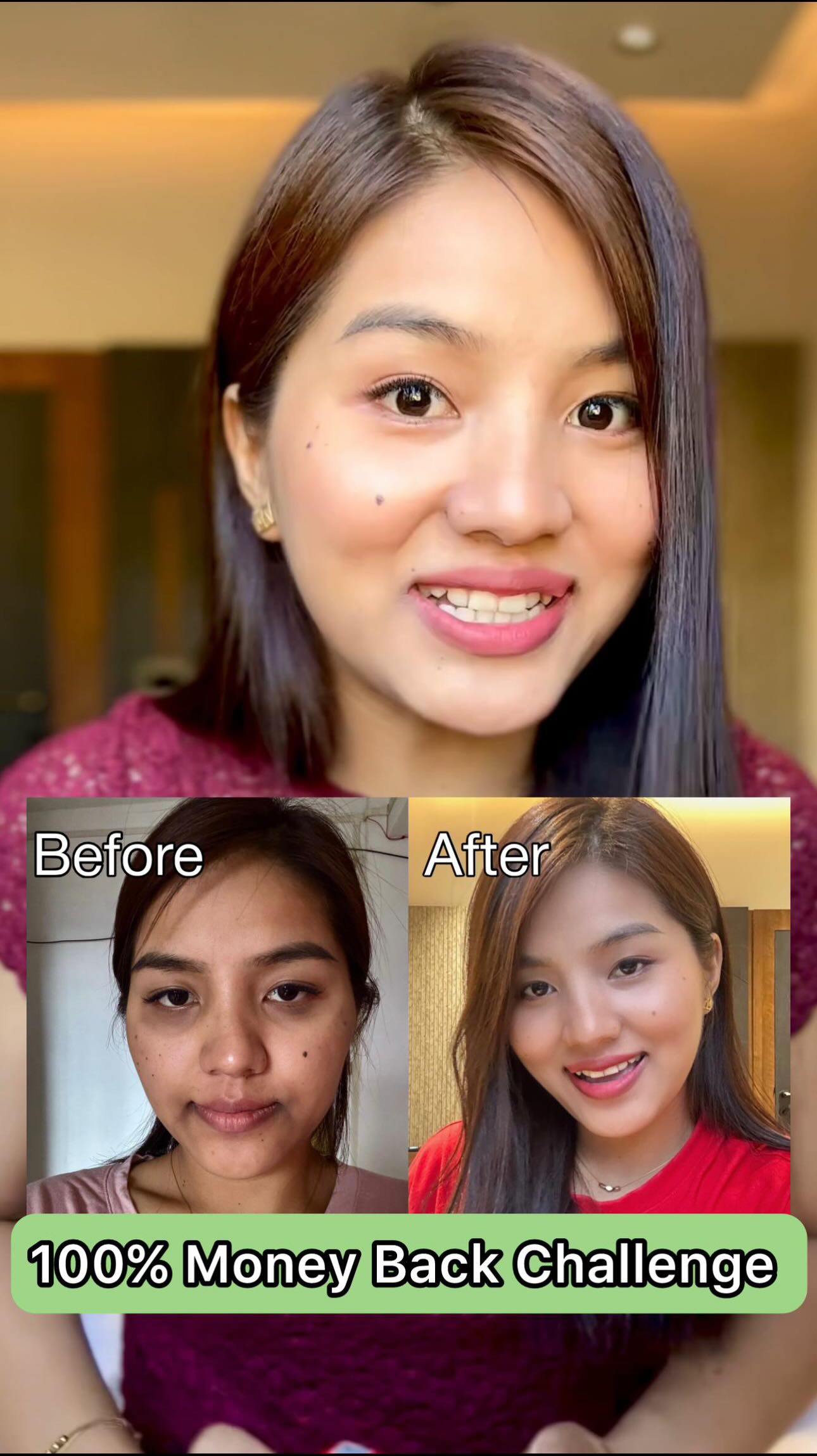 Instagram post by @rody._.5 for Chicnutrix. Caption reads: SHINE tih in lo comment ula LINK in dawng zel ang....