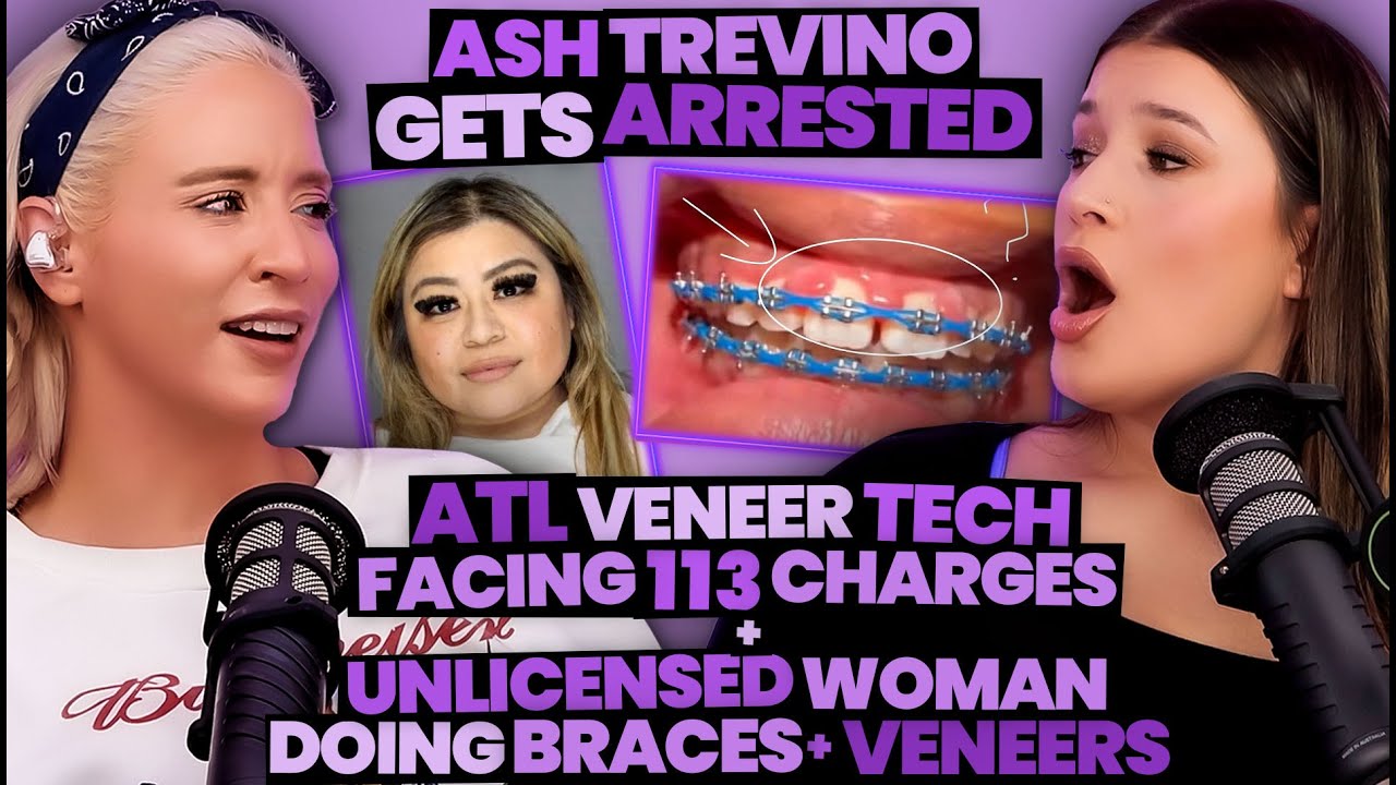 YouTube post by @DoWeKnowThem for Honeylove. Caption reads: Ash Trevino ARRESTED + Veneer Tech Faces 113....
