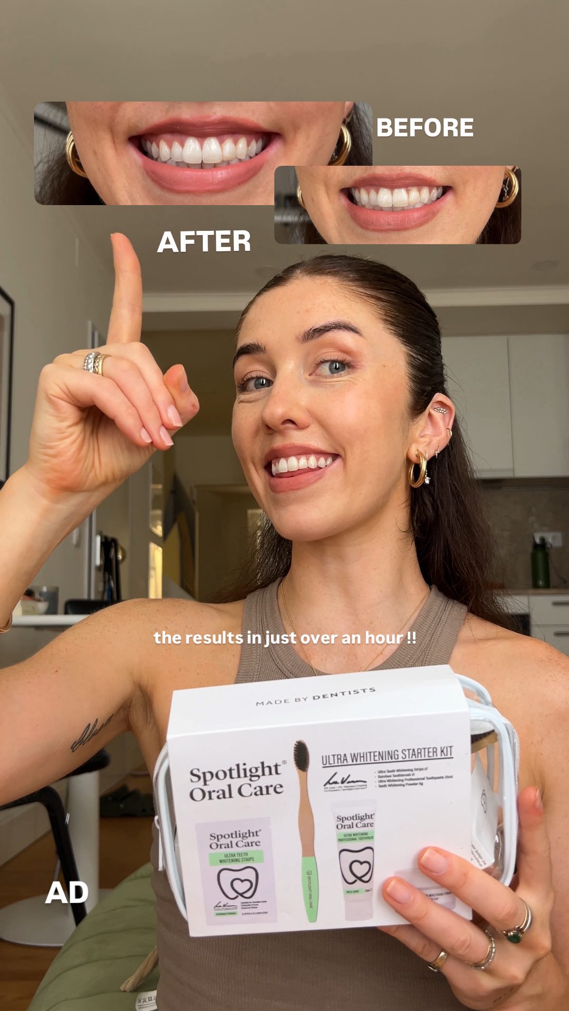 Instagram post by @erica_bracken for Spotlight Oral Care. Caption reads: AD Okayyy these results though 🤌 If you haven’t....