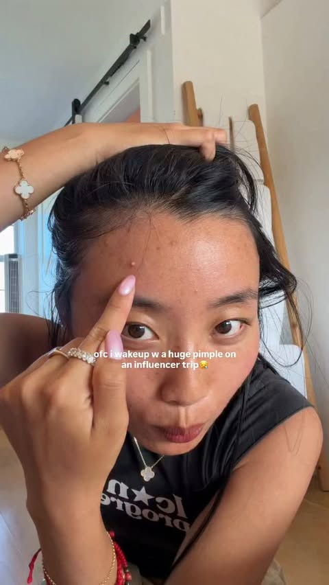 Instagram post by @_alliechen for Hero Cosmetics. Caption reads: [...] of my skin when i meet new ppl😪....