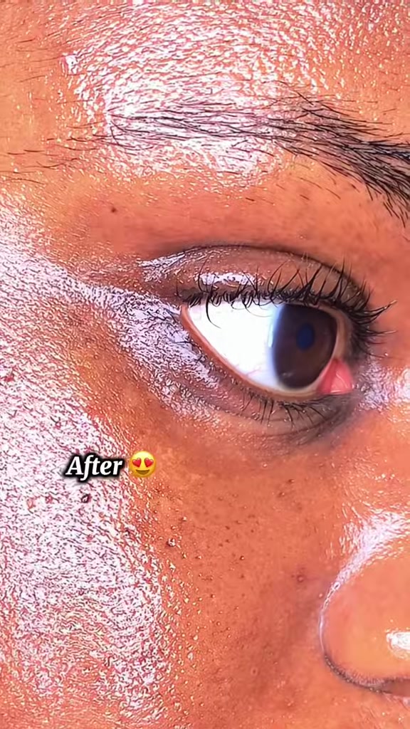 TikTok post by @skinwithjen for Skin1004. Caption reads: #creatorsearchinsights Retinol for dark circles???....