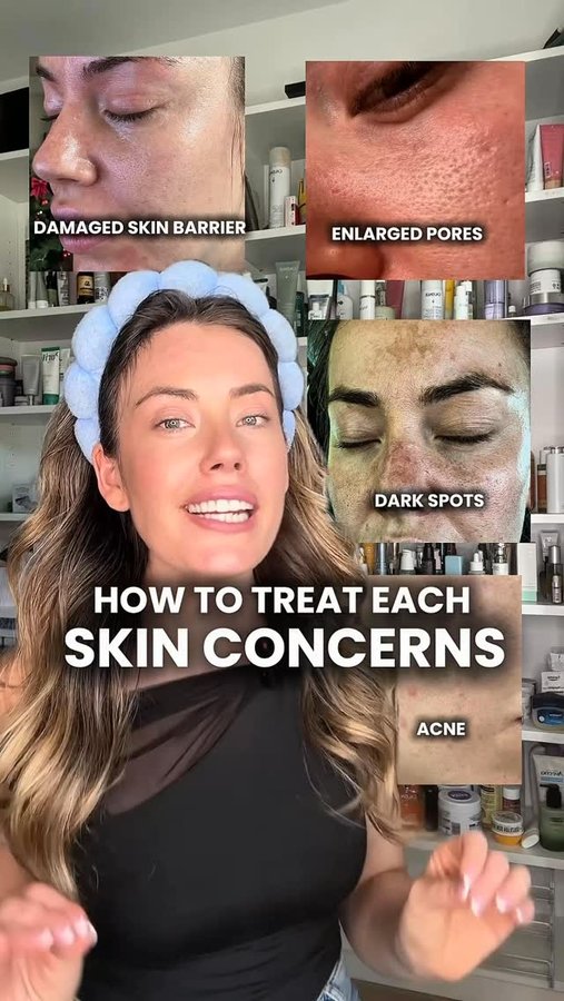 Instagram post by @glowforyourskins for Caudalie. Caption reads: Comment “LINK” and I’ll send you the comedogenic....