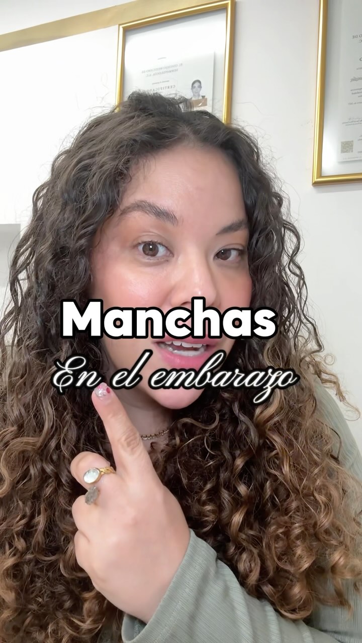 Instagram post by @rosederma for Ducray. Caption reads: Es una de las preguntas que más me hacen y de los....