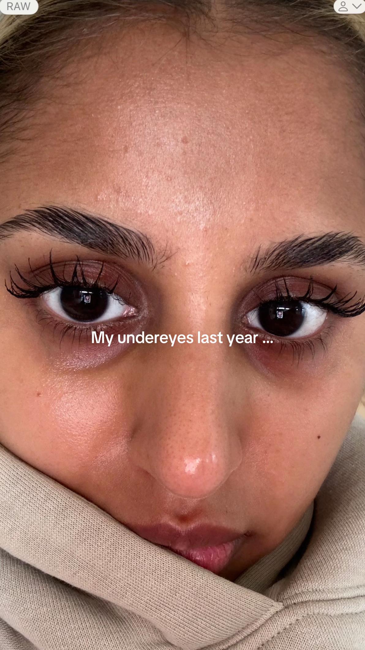 TikTok post by @lailapaul7 for Beauty Of Joseon. Caption reads: [...] each day at a time💗 @Beauty of Joseon ....