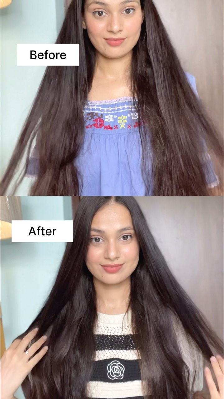 Instagram post by @technicalisrarn for Wish. Caption reads: I have been struggling with oily scalp for so long....