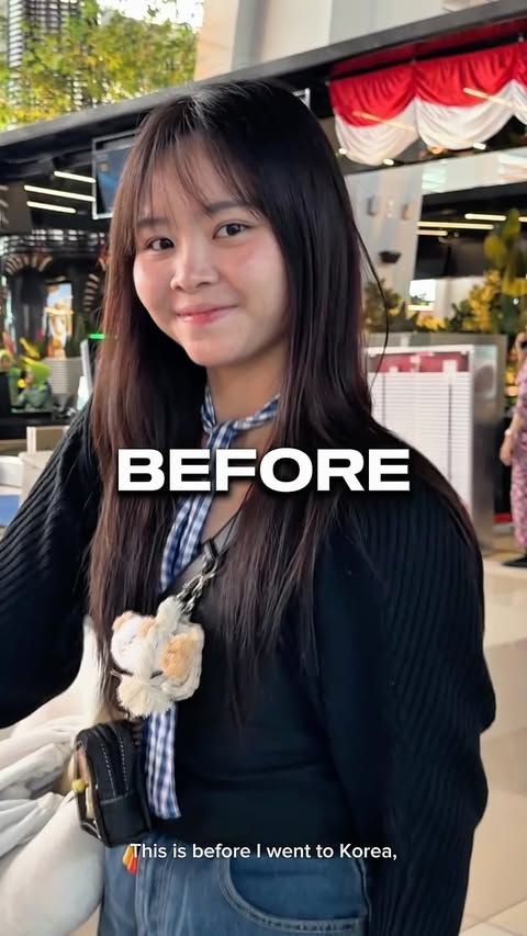 Instagram post by @chikacallistaa for Orta Clinic. Caption reads: [...] best decision bgt buat treatment di....