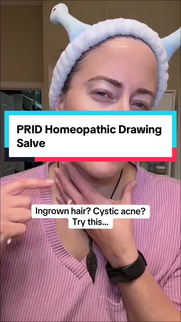 TikTok post by @holli_unfiltered for Hyland's Naturals. Caption reads: #drawingsalve #homeopathic #holistic #ingrownhair....