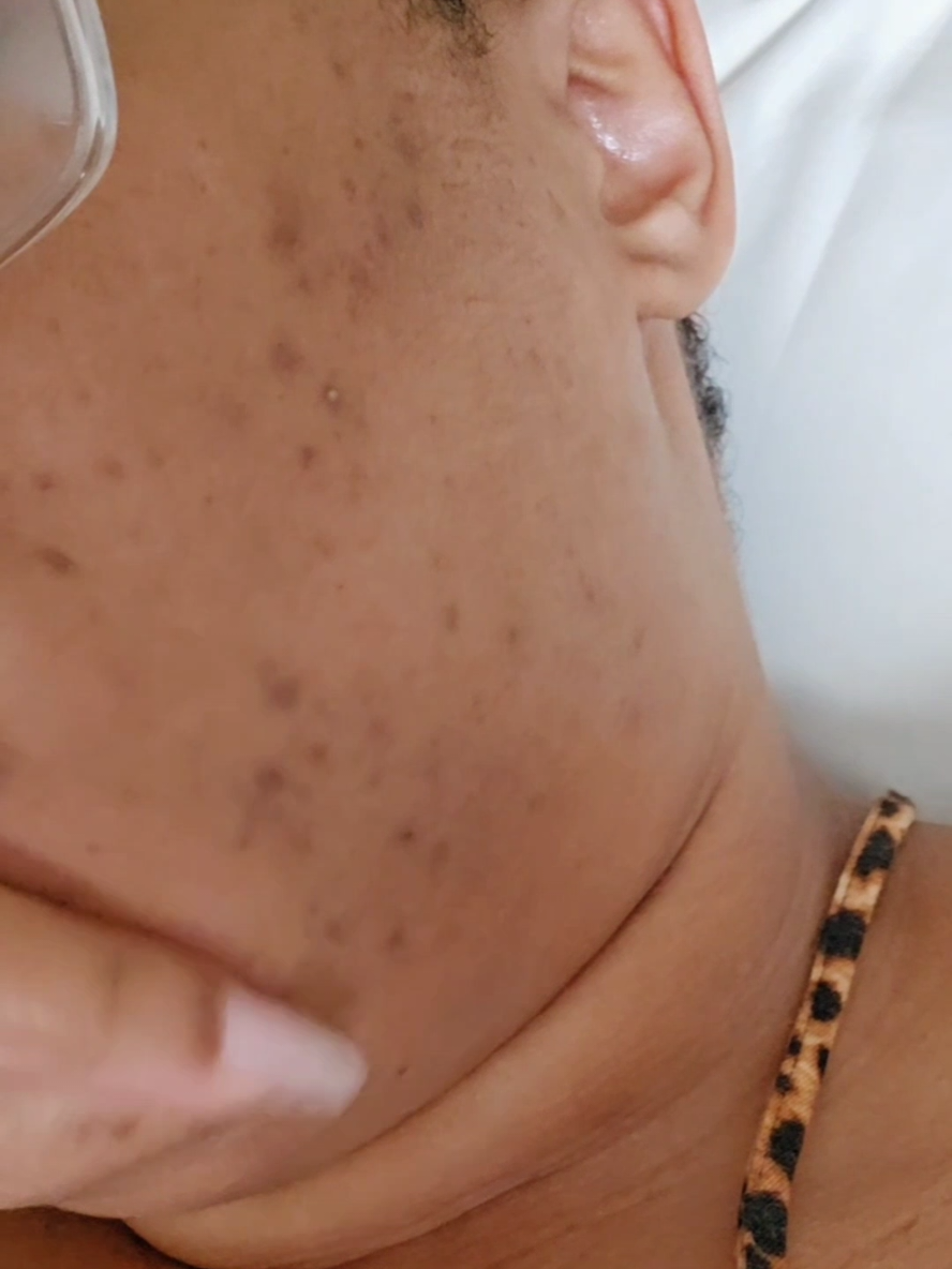 TikTok post by @brittbratstyles for philosophy. Caption reads: Skin Update #beauty #beautysecrets #skincare....