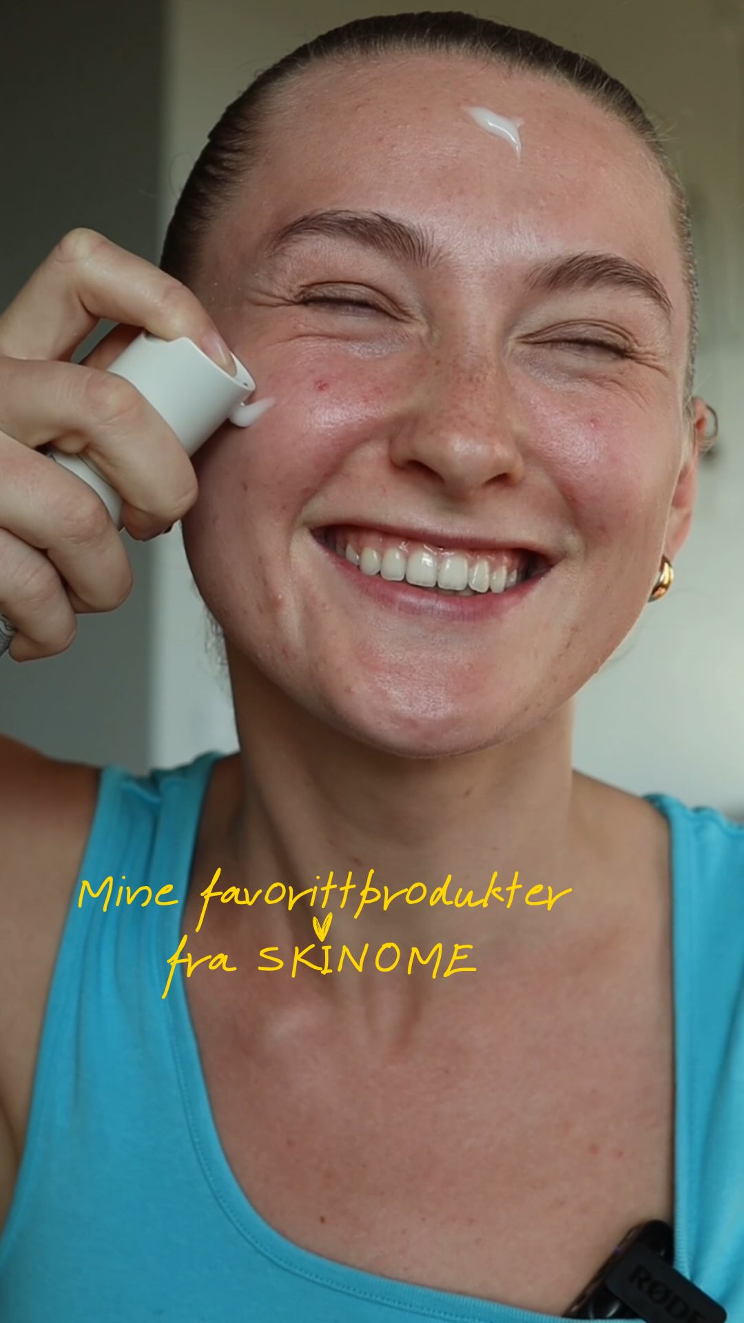 Instagram post by @almaskolmen for Skinome. Caption reads: Reklame Skinome❤️ Jeg snakker ikke ofte om hud,....