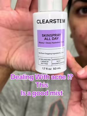 TikTok post by @robertaron for CLEARSTEM Skincare. Caption reads: [...] but it’s is helping my skin @CLEARSTEM....
