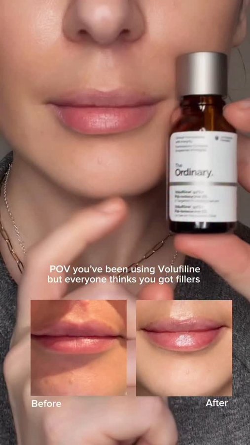 Instagram post by @skin_vestmentt for The Ordinary. Caption reads: You guys that have been here a while know I love a....