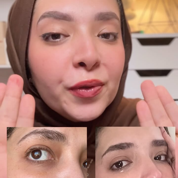 Instagram post by @dr_mennatullah_ for DERMA•E. Caption reads: سحر لعلاج مشاكل الجسم و البشره مع بعض 🤍.