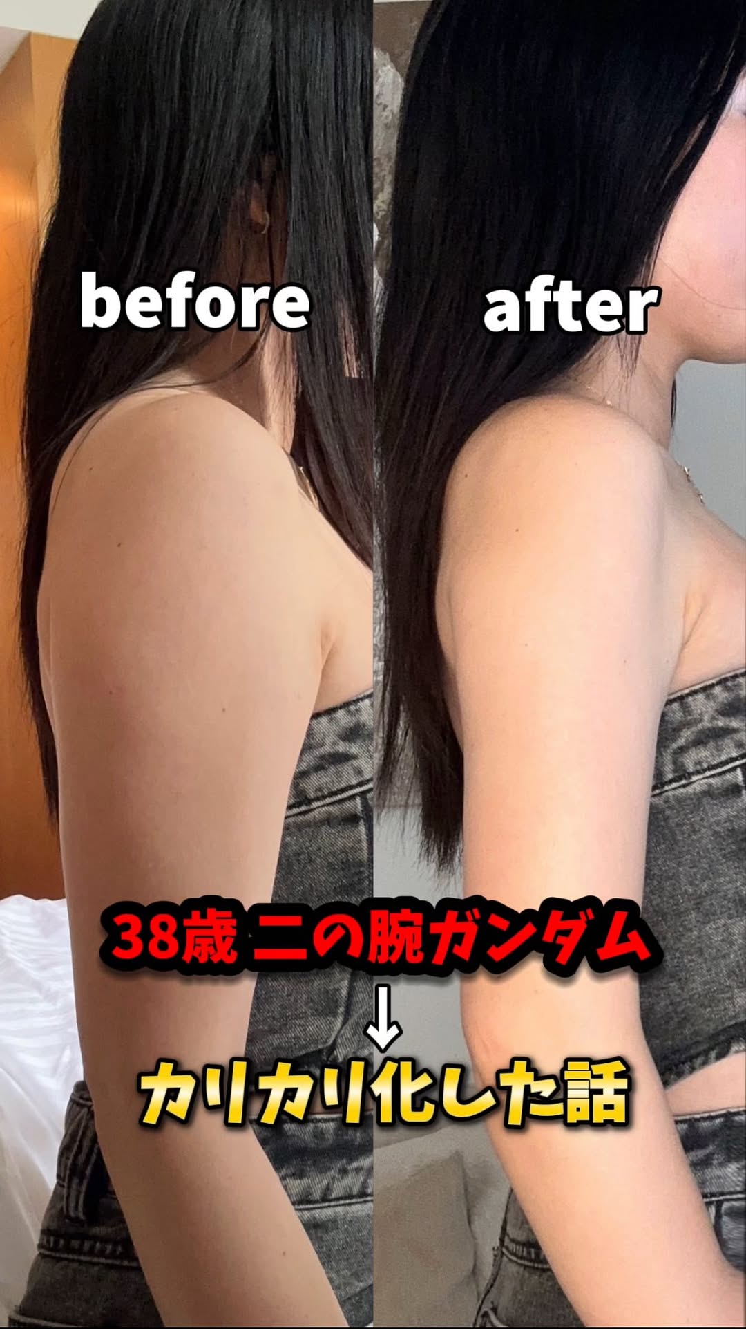 Instagram post by @furuuchimayumi for Xenia Clinic. Caption reads: 38歳、運動ゼロで細くなった話

ダイエットしても
二の腕コンプレックスがエグすぎて😇

渡韓して....