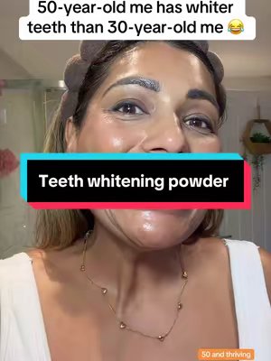 TikTok post by @sheena.tiktok76 for Icy Bear Dental. Caption reads: If younger me could see my teeth now 👀😂 I wish....