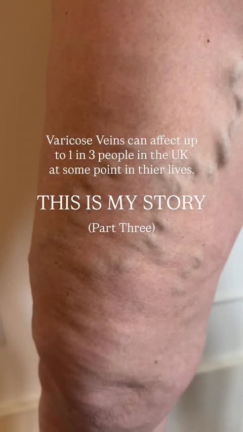 Instagram post by an influencer for Veincentre. Caption reads: [...] and the lovely team at @veincentreofficial....