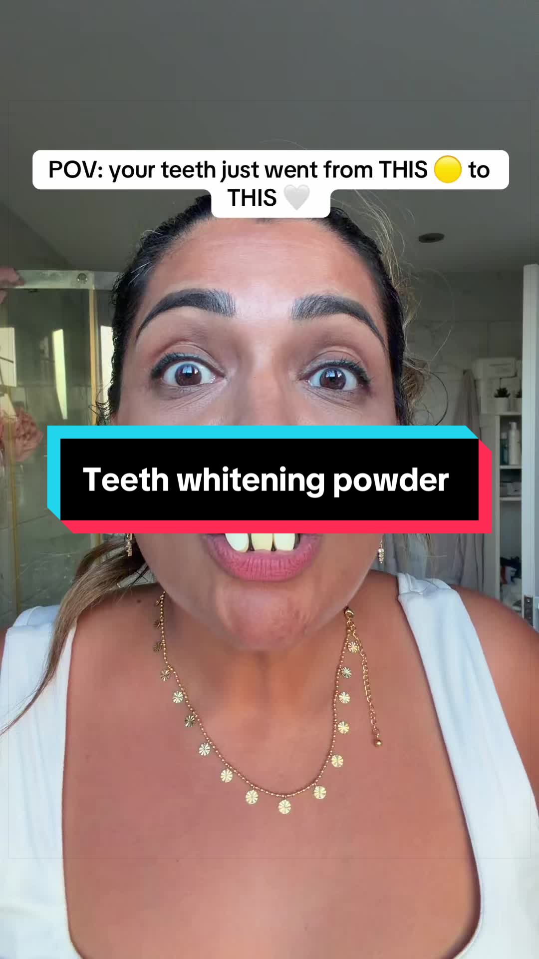 TikTok post by @sheena.tiktok76 for Icy Bear Dental. Caption reads: From yellow to BRILLIANT white 🤍✨ This teeth....