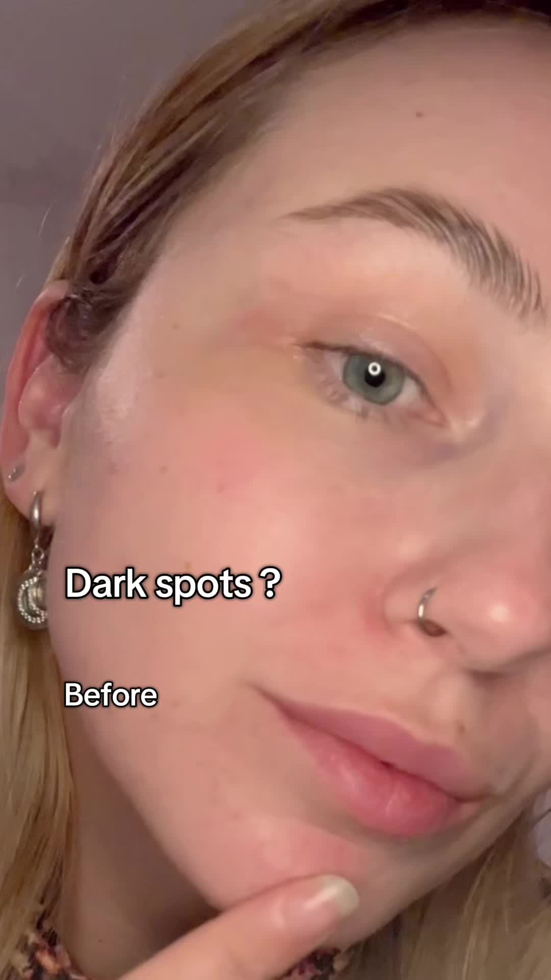 TikTok post by @alexegeorgiana97 for Picky. Caption reads: CENTELLIAN24 Madeca Mela Capture Ampoule Capsule....